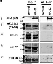 Anti-KLC1 antibody [N2C2], Internal used in Western Blot (WB). GTX114510