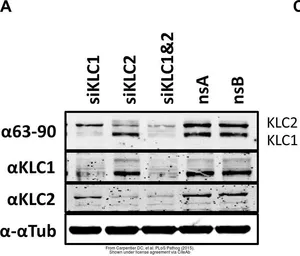 Anti-KLC1 antibody [N2C2], Internal used in Western Blot (WB). GTX114510