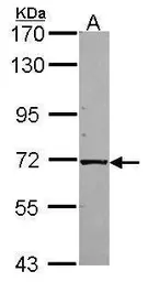 Anti-KLC1 antibody [N2C2], Internal used in Western Blot (WB). GTX114510