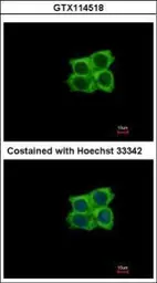 Anti-Ladinin 1 antibody [C1C3] used in Immunocytochemistry/ Immunofluorescence (ICC/IF). GTX114518