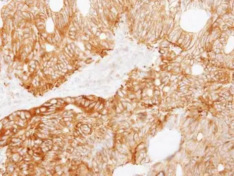 Anti-Ladinin 1 antibody [C1C3] used in IHC (Paraffin sections) (IHC-P). GTX114518