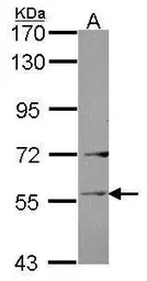 Anti-Ladinin 1 antibody [C1C3] used in Western Blot (WB). GTX114518