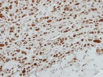 Anti-MAFG antibody used in IHC (Paraffin sections) (IHC-P). GTX114541