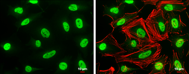 Anti-MAFG antibody used in Immunocytochemistry/ Immunofluorescence (ICC/IF). GTX114541