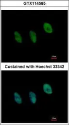 Anti-NFYB antibody [N1C3-2] used in Immunocytochemistry/ Immunofluorescence (ICC/IF). GTX114585