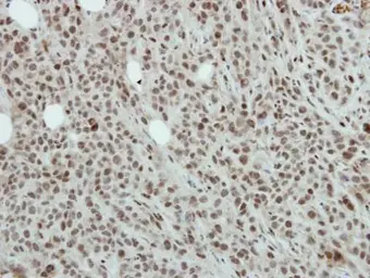 Anti-NFYB antibody [N1C3-2] used in IHC (Paraffin sections) (IHC-P). GTX114585