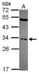 Anti-NFYB antibody [N1C3-2] used in Western Blot (WB). GTX114585