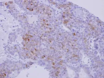 Anti-Nidogen 1 antibody used in IHC (Paraffin sections) (IHC-P). GTX114587