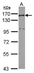 Anti-Nidogen 1 antibody used in Western Blot (WB). GTX114587