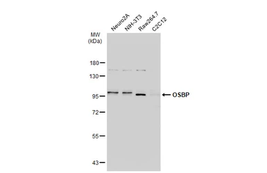 Anti-OSBP antibody [C2C3], C-term used in Western Blot (WB). GTX114603