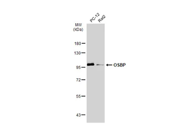 Anti-OSBP antibody [C2C3], C-term used in Western Blot (WB). GTX114603