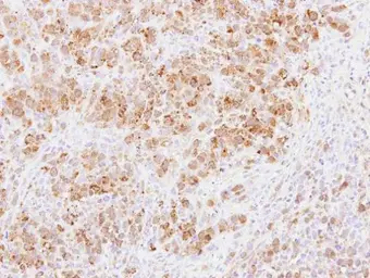 Anti-PABPC3 antibody [N2C1], Internal used in IHC (Paraffin sections) (IHC-P). GTX114612