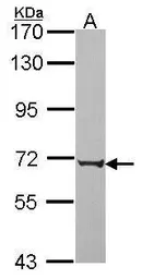 Anti-PABPC3 antibody [N2C1], Internal used in Western Blot (WB). GTX114612