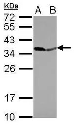 Anti-PPA1 antibody [N2C3] used in Western Blot (WB). GTX114651