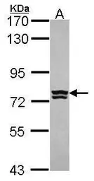 Anti-RNPEP antibody [C1C3] used in Western Blot (WB). GTX114721