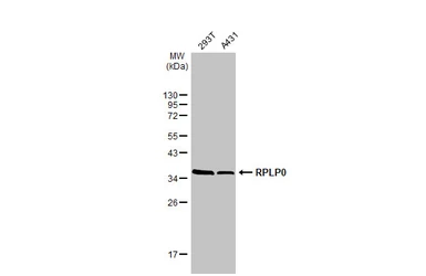 Anti-RPLP0 antibody used in Western Blot (WB). GTX114730