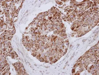 Anti-MRPL12 antibody [N1C3] used in IHC (Paraffin sections) (IHC-P). GTX114731