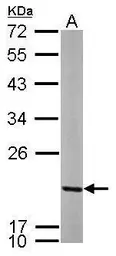 Anti-MRPL12 antibody [N1C3] used in Western Blot (WB). GTX114731