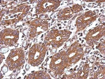 Anti-HAI-1 antibody used in IHC (Paraffin sections) (IHC-P). GTX114793