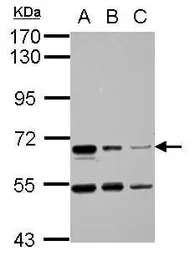 Anti-HAI-1 antibody used in Western Blot (WB). GTX114793