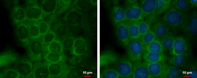 Anti-Staufen antibody used in Immunocytochemistry/ Immunofluorescence (ICC/IF). GTX114803