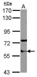 Anti-Staufen antibody used in Western Blot (WB). GTX114803