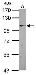 Anti-Elongin A antibody [C2C3], C-term used in Western Blot (WB). GTX114828