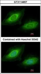 Anti-TSSC1 antibody [N1N3] used in Immunocytochemistry/ Immunofluorescence (ICC/IF). GTX114857