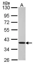 Anti-TSSC1 antibody [N1N3] used in Western Blot (WB). GTX114857