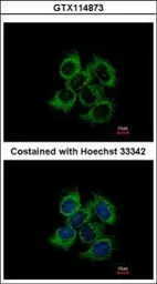 Anti-UQCRC2 antibody used in Immunocytochemistry/ Immunofluorescence (ICC/IF). GTX114873