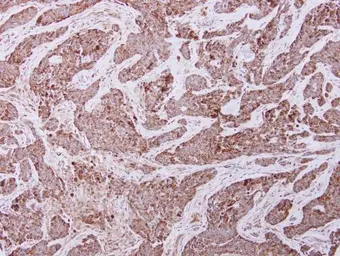 Anti-UQCRC2 antibody used in IHC (Paraffin sections) (IHC-P). GTX114873