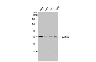 Anti-ABCB7 antibody [C1C3] used in Western Blot (WB). GTX114916