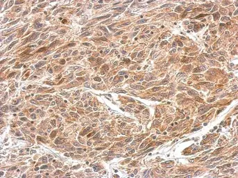 Anti-CRMP1 antibody used in IHC (Paraffin sections) (IHC-P). GTX114940