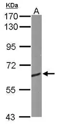 Anti-CRMP1 antibody used in Western Blot (WB). GTX114940