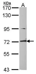 Anti-CRMP1 antibody used in Western Blot (WB). GTX114940