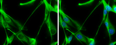 Anti-Transaldolase antibody [N2C3] used in Immunocytochemistry/ Immunofluorescence (ICC/IF). GTX114956