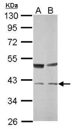 Anti-Transaldolase antibody [N2C3] used in Western Blot (WB). GTX114956