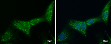 Anti-ATP synthase B1 antibody [N1C3] used in Immunocytochemistry/ Immunofluorescence (ICC/IF). GTX114970