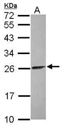 Anti-ATP synthase B1 antibody [N1C3] used in Western Blot (WB). GTX114970