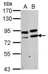 Anti-PARN antibody used in Western Blot (WB). GTX115020