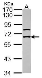 Anti-GABA Receptor Epsilon antibody [N1N3] used in Western Blot (WB). GTX115026