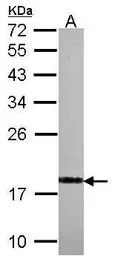 Anti-Visinin-like 1 antibody used in Western Blot (WB). GTX115039