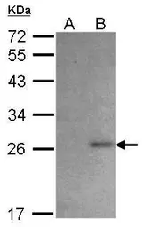 Anti-6X His tag antibody (HRP) used in Western Blot (WB). GTX115045-01