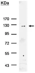 Anti-6X His tag antibody used in Immunoprecipitation (IP). GTX115045