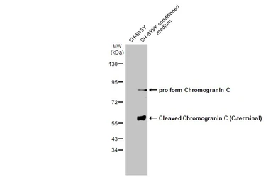 Anti-Chromogranin C antibody used in Western Blot (WB). GTX115049