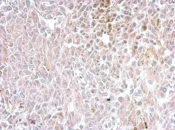 Anti-Chromogranin C antibody used in IHC (Paraffin sections) (IHC-P). GTX115049