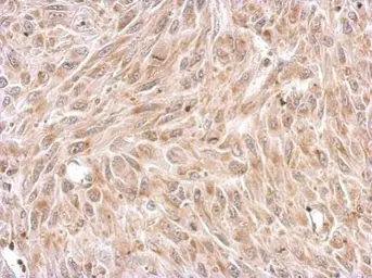 Anti-Chromogranin C antibody used in IHC (Paraffin sections) (IHC-P). GTX115049