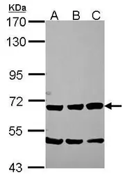 Anti-Chromogranin C antibody used in Western Blot (WB). GTX115049