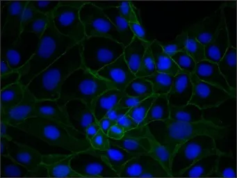 Anti-gamma Catenin antibody [15F11] used in Immunocytochemistry/ Immunofluorescence (ICC/IF). GTX11506