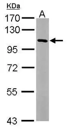 Anti-USP5 antibody [N1N3] used in Western Blot (WB). GTX115063